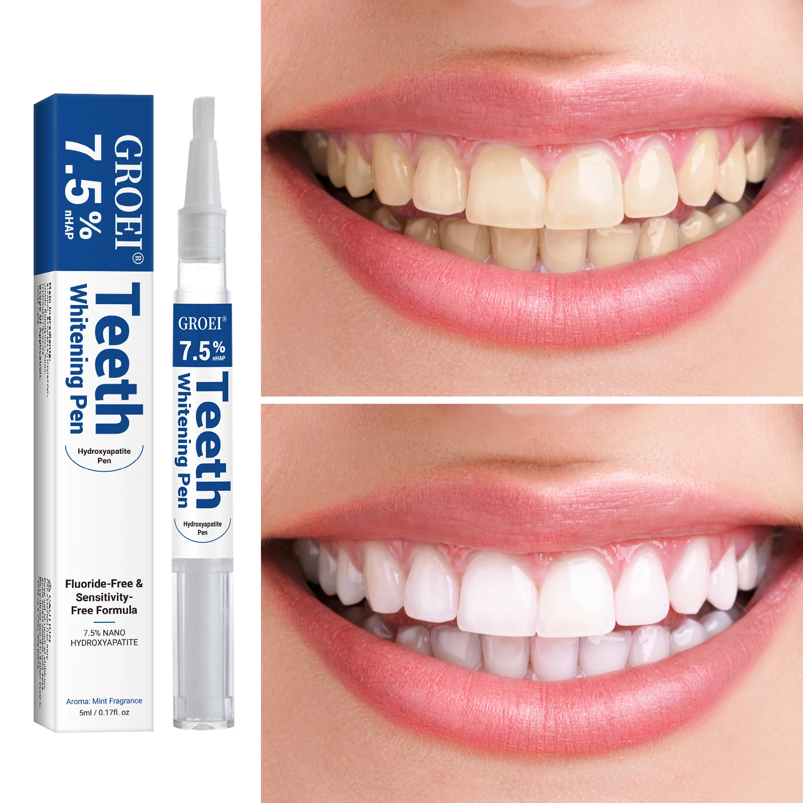 Pena Pemutih Gigi Hidroksiapat - Teeth Whitening With Peroxide ulasan dan harga
