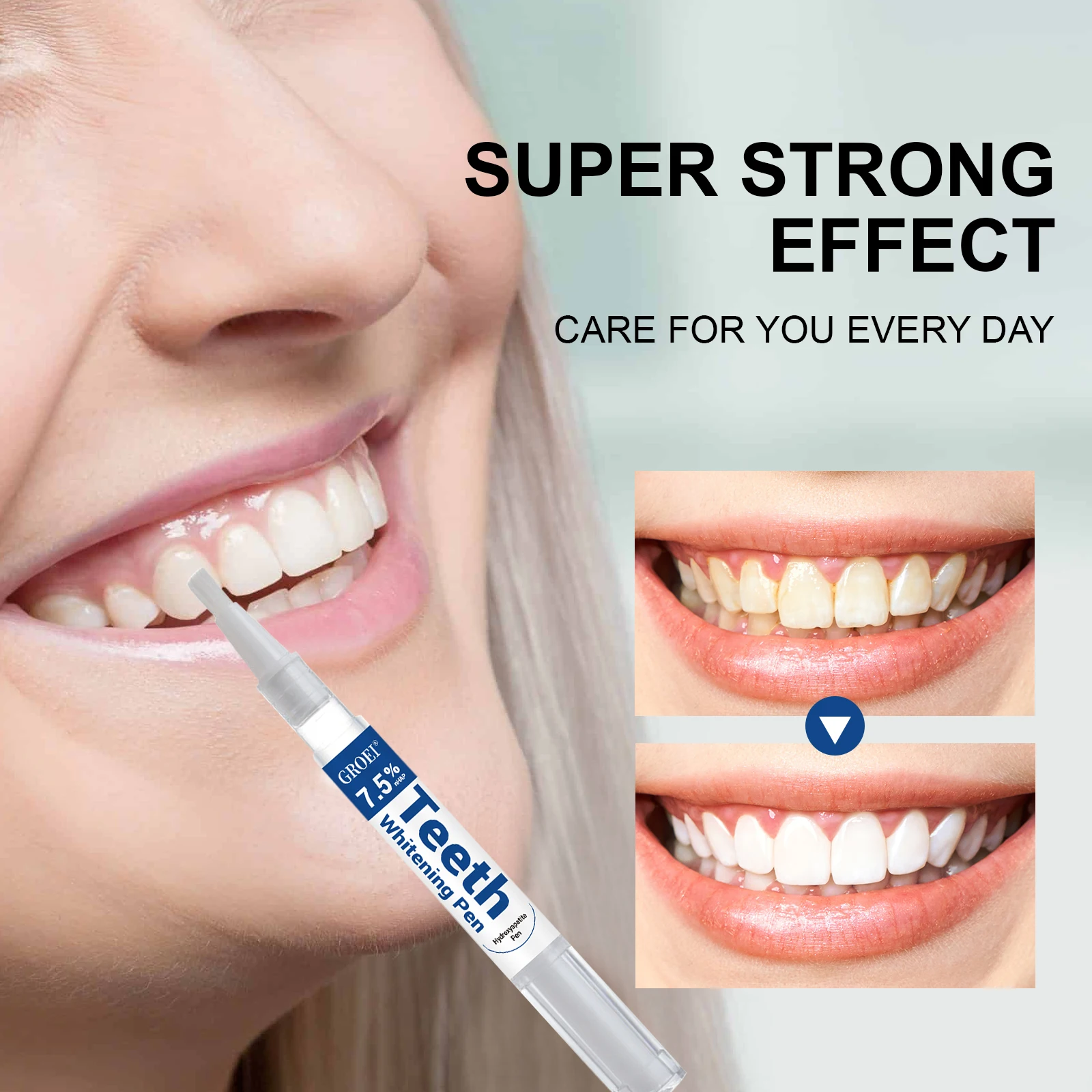 Pena Pemutih Gigi Hidroksiapat - Teeth Whitening With Peroxide ulasan dan harga