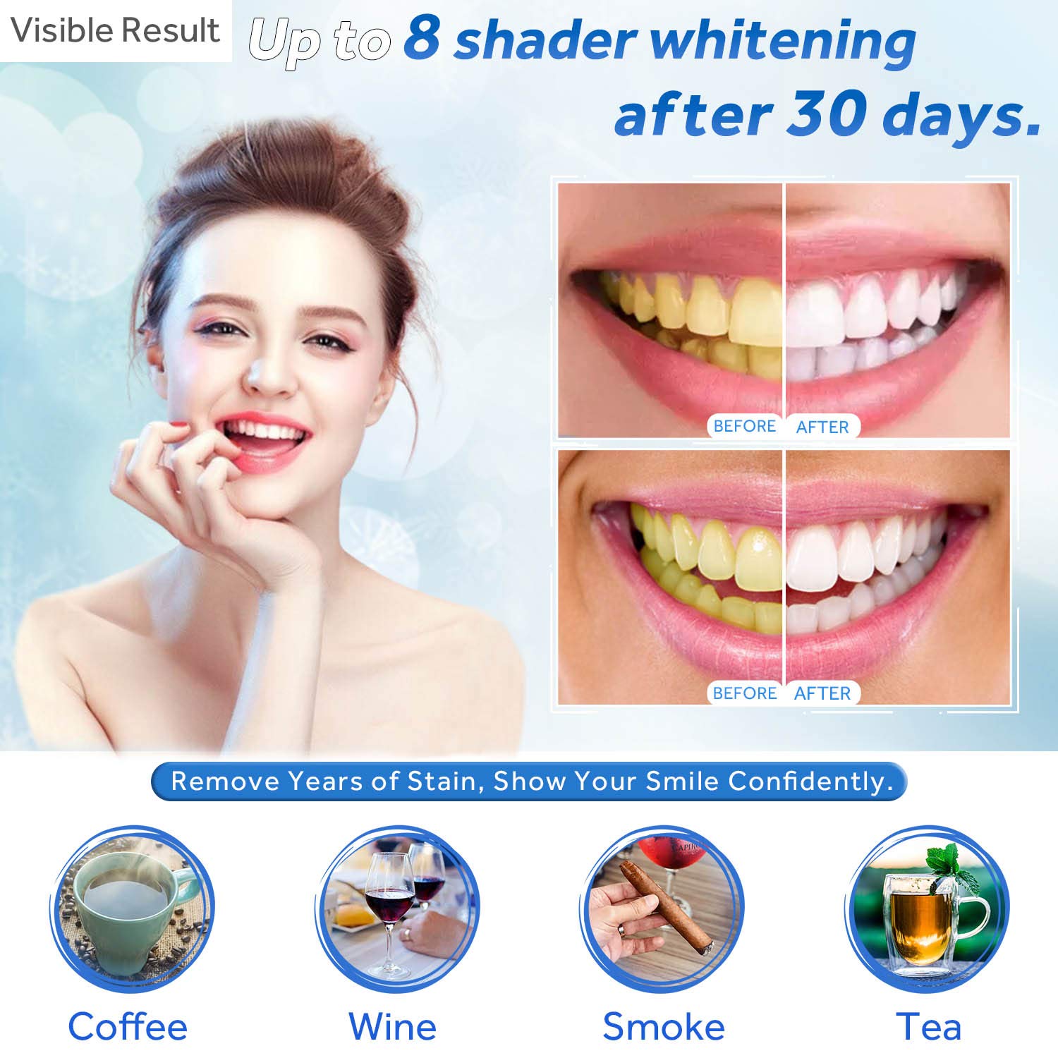Gel Pemutih Gigi Isi Ulang Syr - Teeth Whitening Before And After ulasan dan harga
