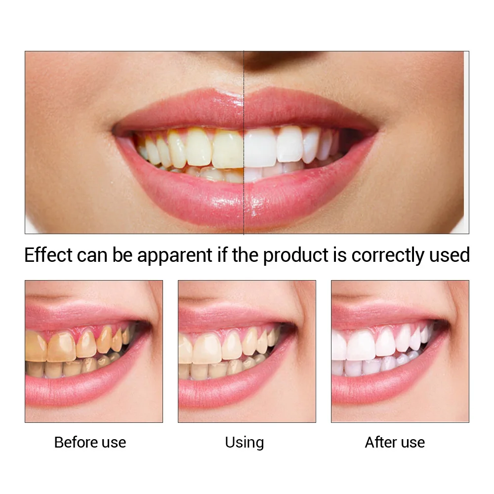 FTEENPLY Bubuk Esensi Pemutih  - Teeth Whitening Groupon ulasan dan harga