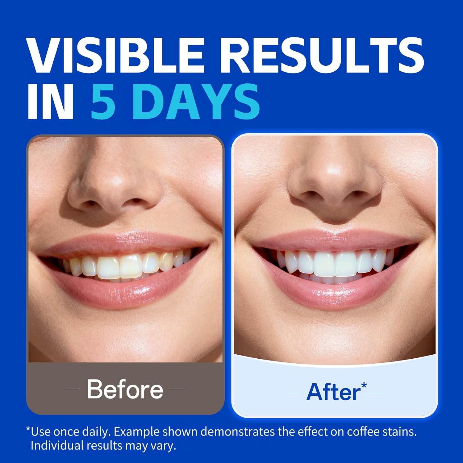1/7 Pasang Strip Pemutih Gigi  - Teeth Whitening Strips Crest ulasan dan harga